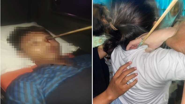 Bentrok Layang-Lembo Merembet, Warga Tak Berdosa Jadi Korban Busur Panah