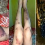 Biadab! Suami Karates di Bulukumba Hajar Istri Hamil Hingga Lebam, Netizen: Tangkap Sekarang!