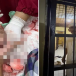 Ngeri di Jeneponto, Pria Penolak Prostitusi Ditebas Hingga Tangan Nyaris Putus