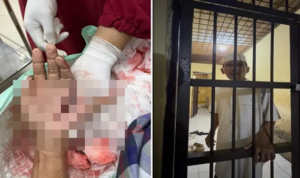 Ngeri di Jeneponto, Pria Penolak Prostitusi Ditebas Hingga Tangan Nyaris Putus