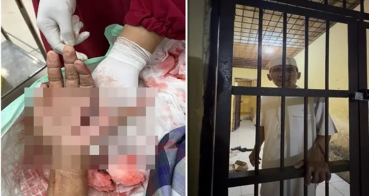 Ngeri di Jeneponto, Pria Penolak Prostitusi Ditebas Hingga Tangan Nyaris Putus