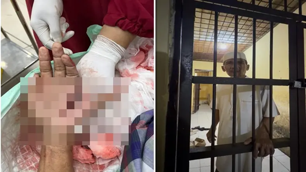 Ngeri di Jeneponto, Pria Penolak Prostitusi Ditebas Hingga Tangan Nyaris Putus