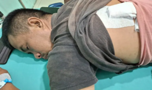 Kesepakatan Pengobatan Dilanggar, Polisi Didesak Tindak Pembacok Pedagang Percut Sei Tuan